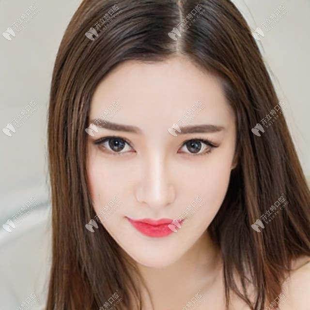 珠海牙齒矯正價格表送你啦，里面有在珠海帶牙套的費用哦