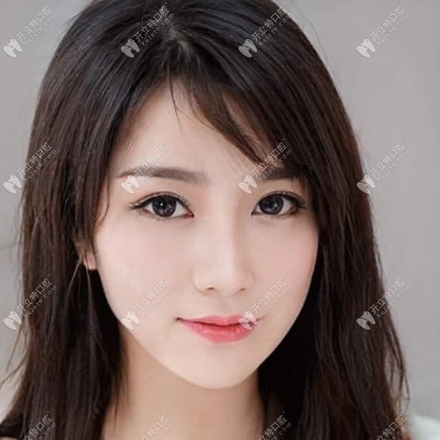 關(guān)注：日本拓美tomy OPA-K直絲弓自鎖矯治技術(shù)怎么樣