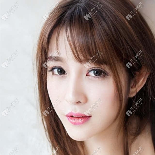 凸嘴齙牙正畸拔智齒推磨牙向后和拔4號牙哪個更好?