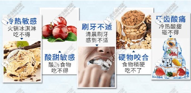 牙齒敏感的癥狀