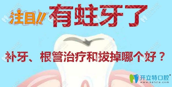 蛀牙的治療方法有補(bǔ)牙根管治療和醫(yī)學(xué)拔除