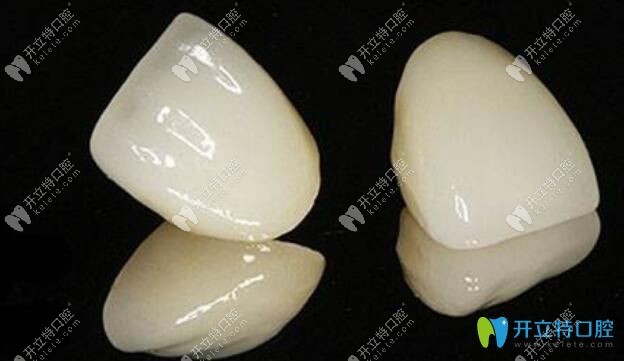 全瓷牙补救树脂补门牙缝隙后悔的情况