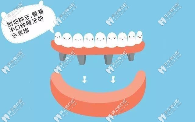 武漢德韓口腔種植牙活動(dòng)