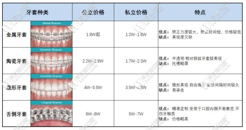 骨性凸嘴不同牙套矫正费用
