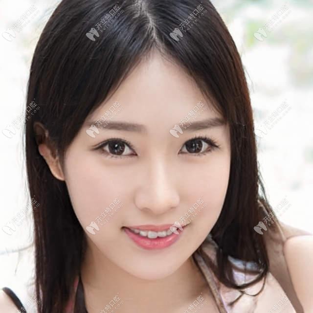 以德國非凡和美國3M為例,說說主動/被動自鎖托槽的矯正原理