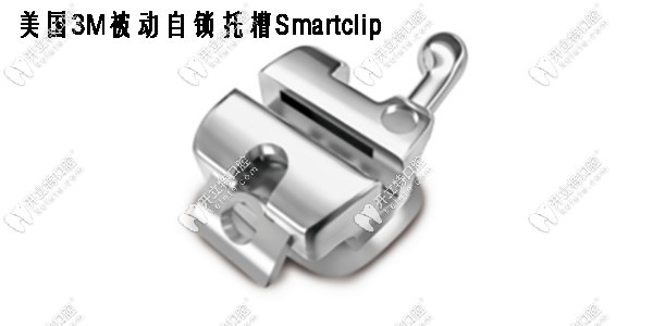 美國3M被動自鎖托槽SmartClip