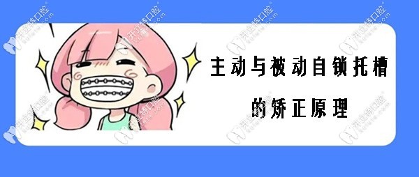 主動自鎖與被動自鎖托槽的矯正原理