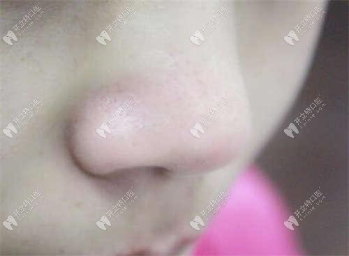 天津美萊口腔是正規(guī)的嗎?來這享受隱適美正畸就很靠譜