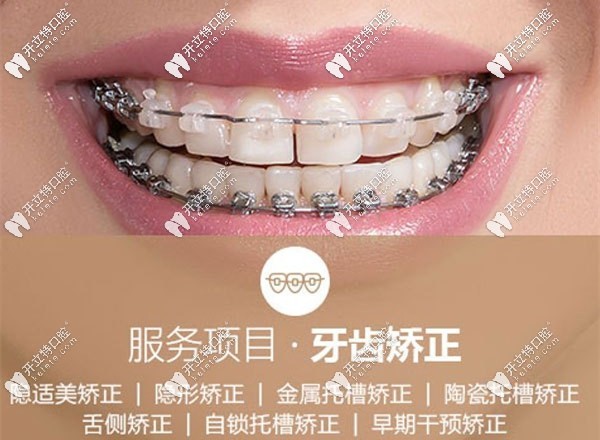 越秀區(qū)陽光樹口腔的寒假正畸福利
