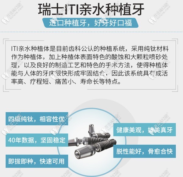 瑞士iti种植牙优势kelete.com