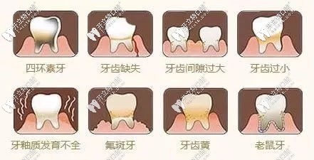 牙齒貼面可以解決問(wèn)題