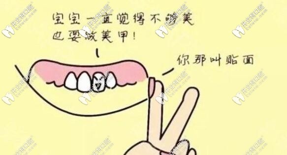 牙齒貼面
