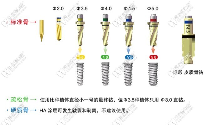 奥齿泰不同型号的钻对应的植体尺寸