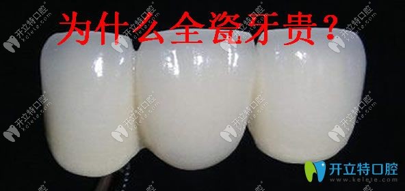 為什么全瓷牙比烤瓷牙貴幾倍