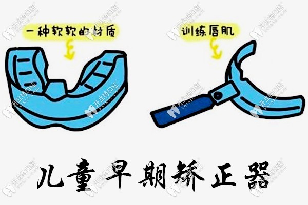 孩子換牙齒的時(shí)候要注意需不需要早期干預(yù)