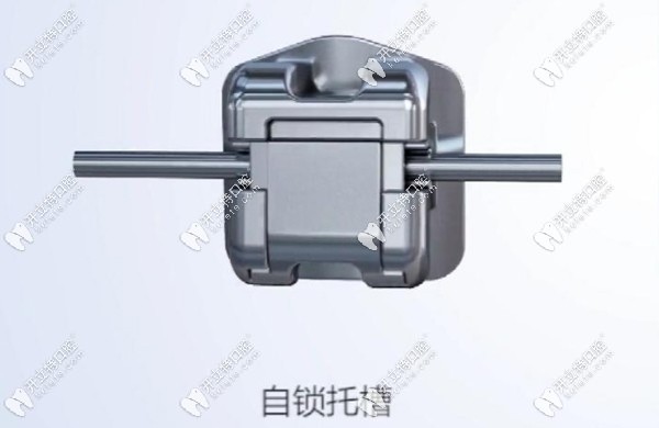 金屬自鎖托槽矯正