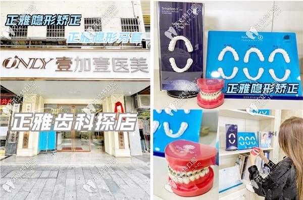 壹加壹口腔特邀的正畸名醫(yī)坐診
