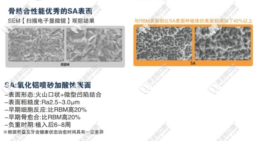 奥齿泰ts3 SA植体表面处理和过去对比