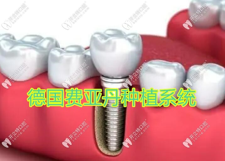 德国费亚丹种植系统