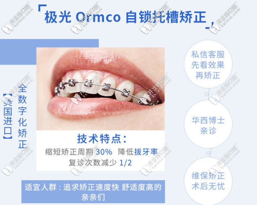 奧美科自鎖托槽矯正的優(yōu)勢