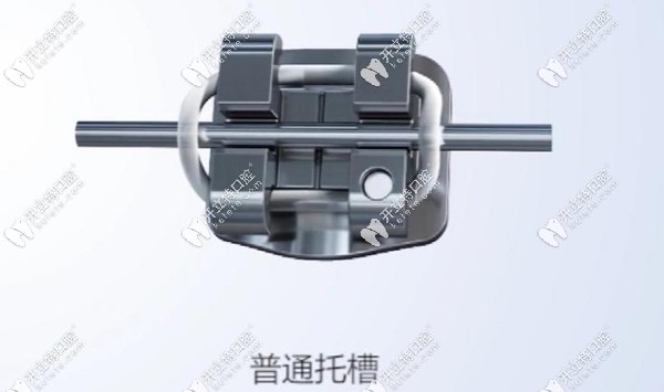 傳統(tǒng)金屬矯正器