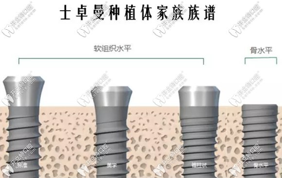 瑞士士卓曼種植體價格
