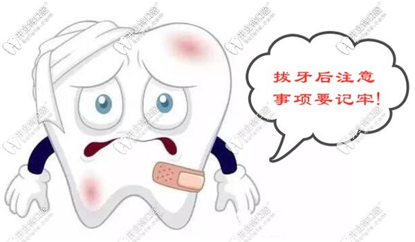 拔牙后注意事項(xiàng)