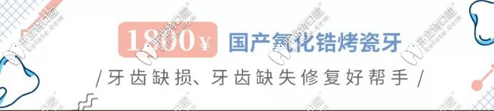 國產(chǎn)氧化皓烤瓷牙價格1800元起/顆