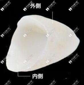 全瓷冠內(nèi)外側(cè) 全瓷冠內(nèi)外側(cè)