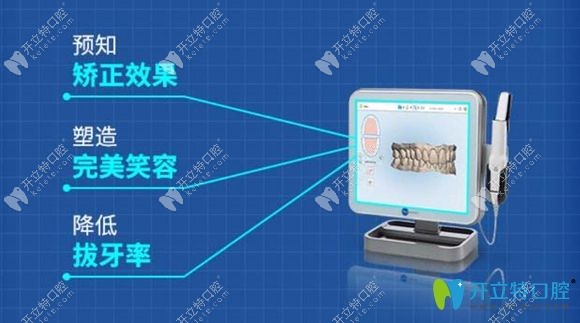 時代天使iTero口掃儀