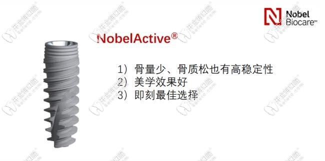 諾貝爾active植體優(yōu)勢