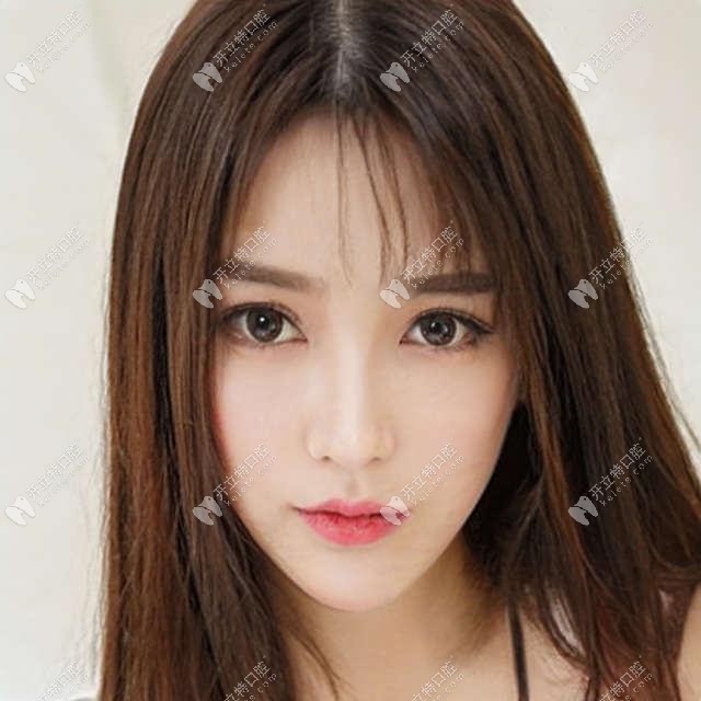 口腔上頜骨贗復(fù)體修復(fù)是什么意思?具體的制作流程是什么