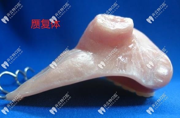 口腔內(nèi)制作好贗復(fù)體