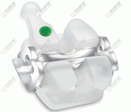陶瓷牙套的優(yōu)點(diǎn)之一是不含金屬成份