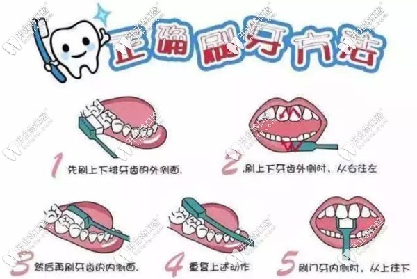 正確的刷牙方式圖解