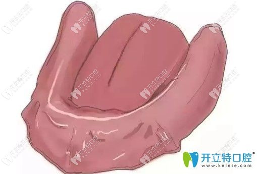 中諾口腔全口義齒種植圖