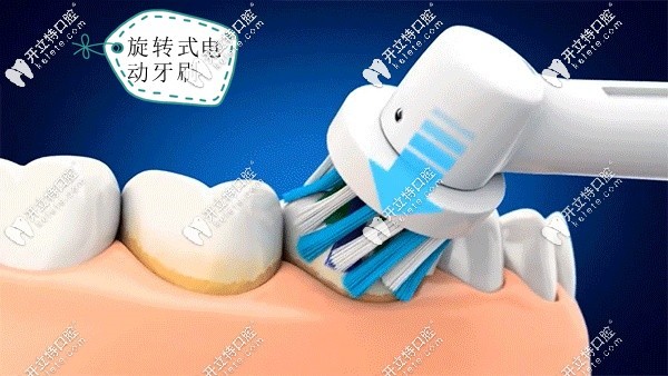 旋轉(zhuǎn)式電動(dòng)牙刷