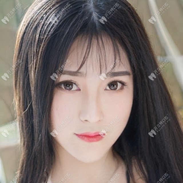 揭開天津中諾口腔種植牙全過程,含單顆/多顆和全口義齒種植