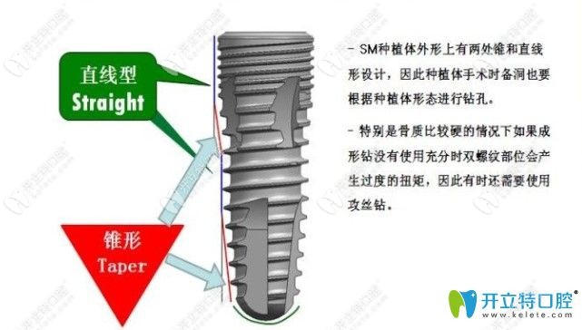 韓國dio種植系統(tǒng)的型號有哪些