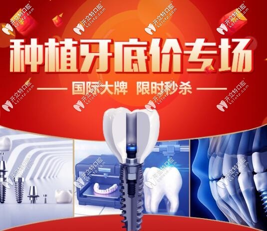 西安諾貝爾口腔門(mén)診部種植牙<span style=