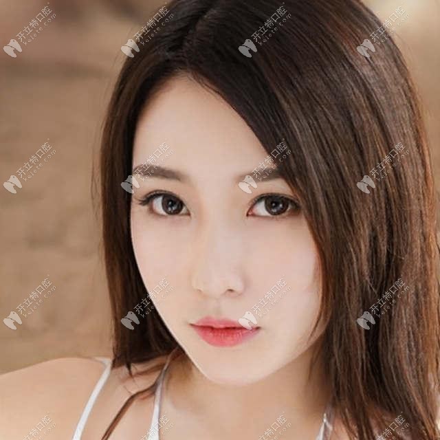骨性地包天必须做正颌手术吗?地包天手术有风险还敢做