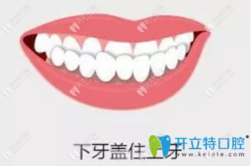 牙齒地包天圖片