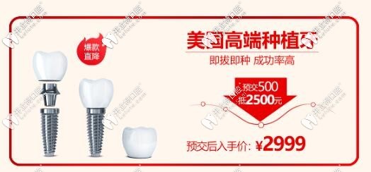 西安諾貝爾牙科美國(guó)高端皓圣種植牙價(jià)格