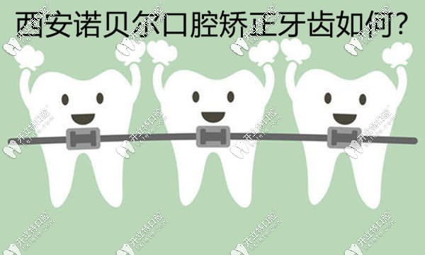 西安雁塔區(qū)諾貝爾口腔矯正牙齒好不好