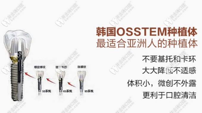 韓國進口奧齒泰種植系統(tǒng)的優(yōu)點