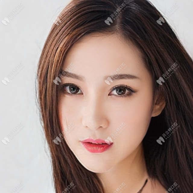 西安諾貝爾口腔矯正牙齒好不好，用正畸病例來評價下