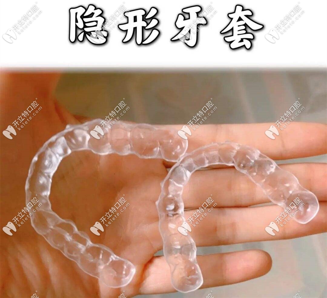隱形牙套的外觀
