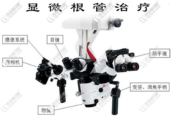 顯微根管治療