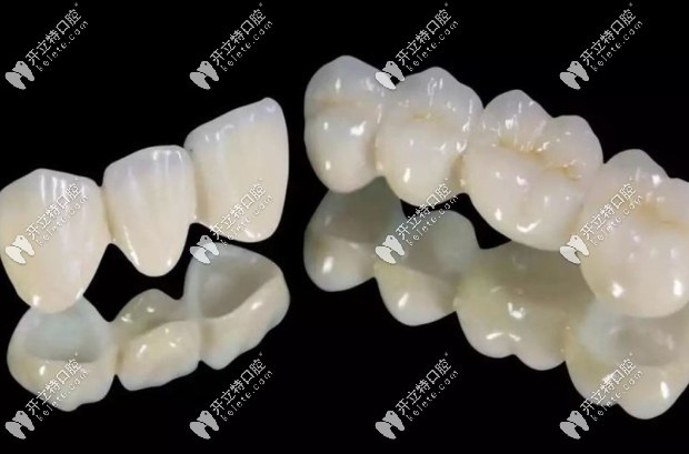 牙齒貼面和全瓷牙哪個(gè)更牢固