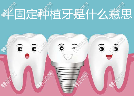 半固定種植牙是什么意思？